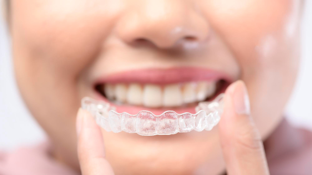 Dr. Betül Nazlı ile istanbul invisalign Yöntemi