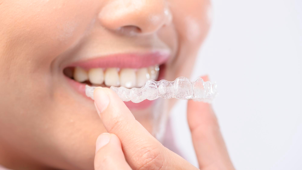 Dr. Betül Nazlı ile istanbul invisalign Yöntemi