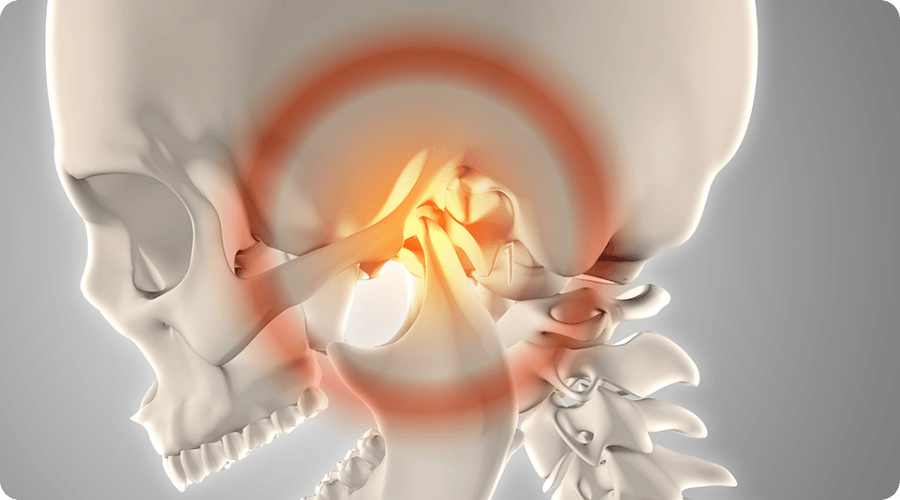 kadikoy Cene Eklemi TME tedavisi dr betul nazli