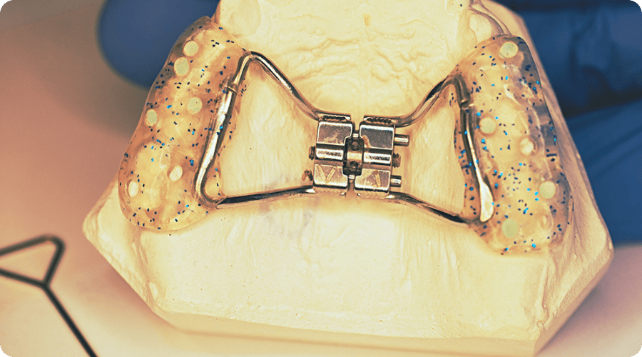 kadikoy cene genisletme tedavisi dr betul nazli 1