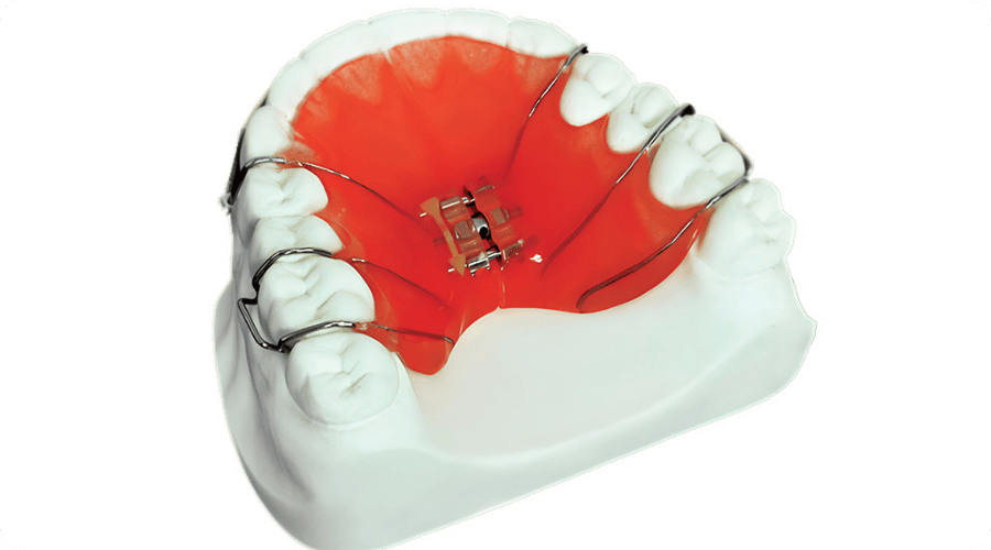 kadikoy cocuklarda ortodonti tedavisi dr betul nazli 2