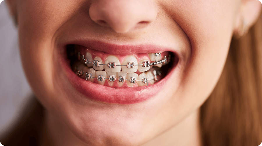 kadikoy sabit dis teli tedavi dr betul nazli 1