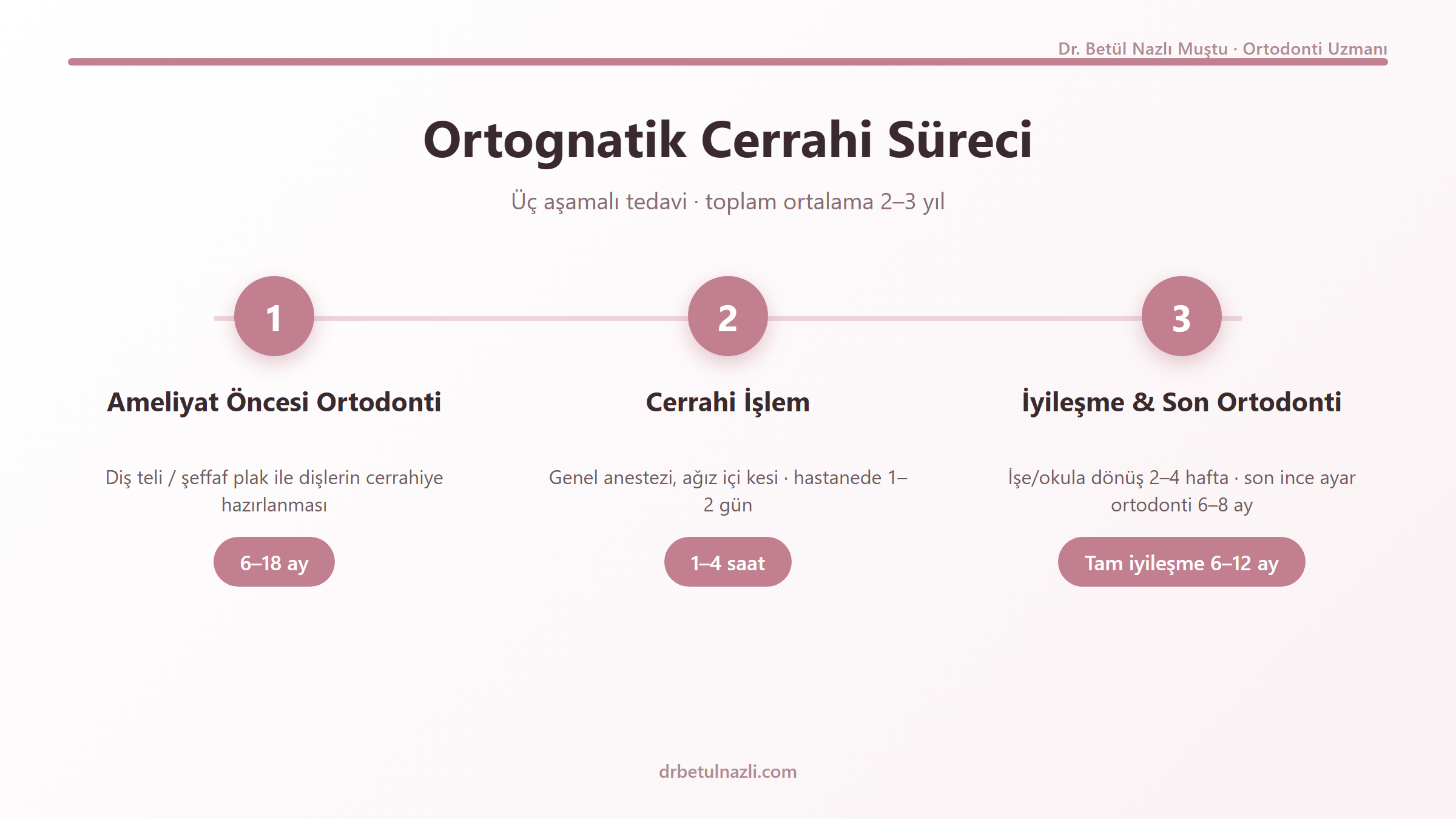 Ortognatik cerrahi süreci zaman çizelgesi: ameliyat öncesi ortodonti 6-18 ay, cerrahi işlem 1-4 saat, iyileşme ve son ortodonti 6-8 ay